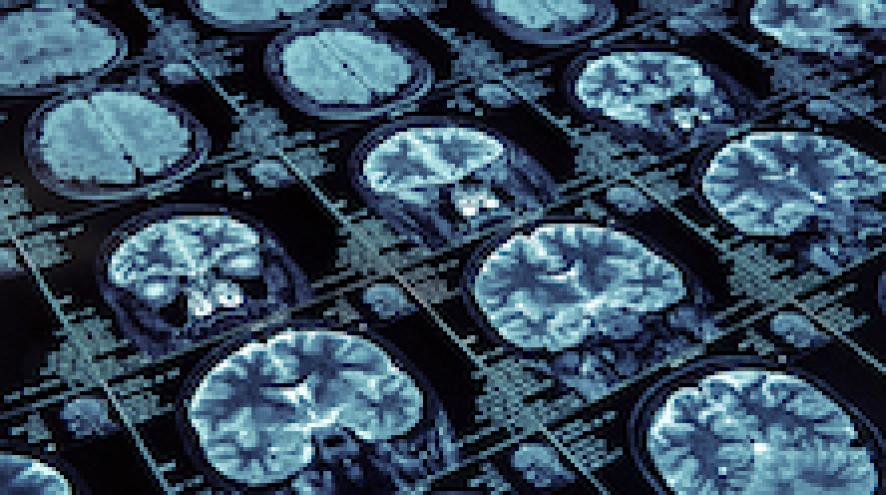 MRI-images.jpg